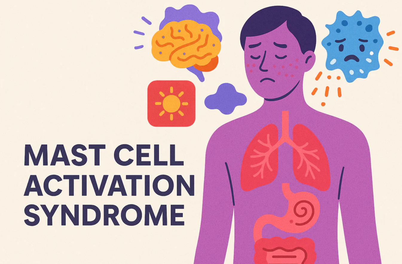 mast cell activation syndrome, mcas symptoms, allergy alternative diagnosis, mast cell disorder treatment, mcas awareness, mcas management, mast cell activation, histamine intolerance, allergy vs mcas, mcas diagnosis
